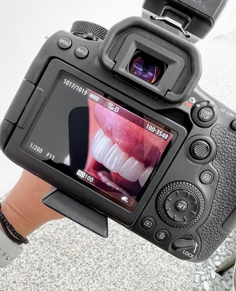 3D томограф для точної діагностики